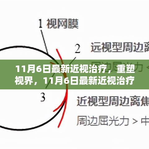 重塑视界，最新近视治疗带来的自信与成就之光——11月6日最新治疗技术解析