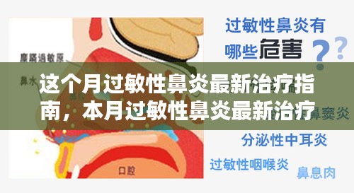 本月过敏性鼻炎最新治疗指南，科学应对，轻松缓解过敏性鼻炎症状