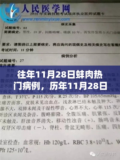 历年11月28日蚌肉病例深度解析与热门病例回顾