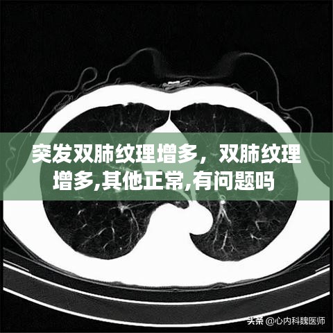 突发双肺纹理增多，双肺纹理增多,其他正常,有问题吗 