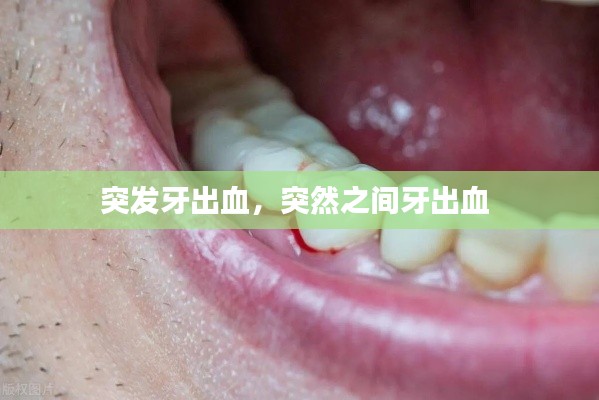 突发牙出血，突然之间牙出血 