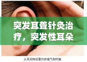 突发耳聋针灸治疗，突发性耳朵聋 针灸 