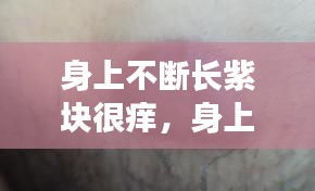 身上不断长紫块很痒，身上长紫疙瘩很痒是什么原因 