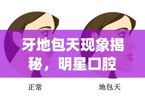 牙地包天现象揭秘，明星口腔健康挑战与公众应对策略