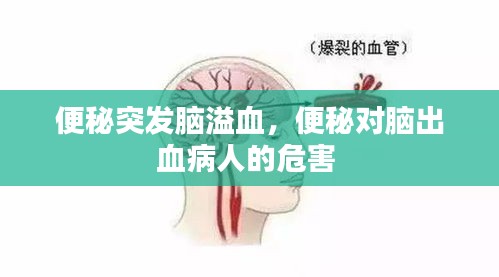 便秘突发脑溢血，便秘对脑出血病人的危害 